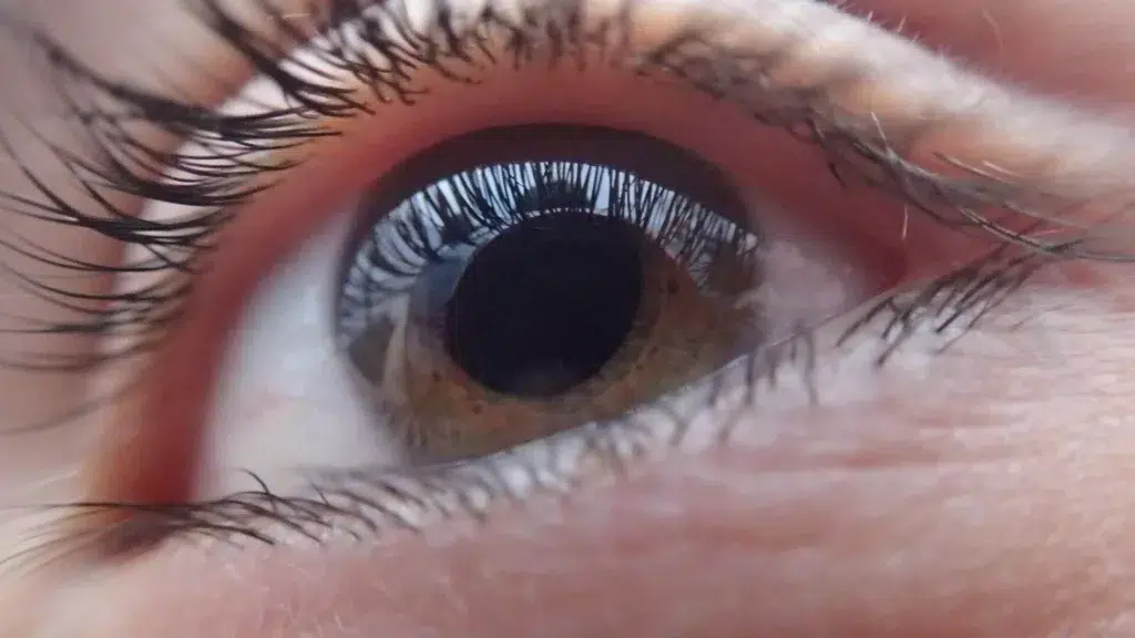 Epilepsie und Auge